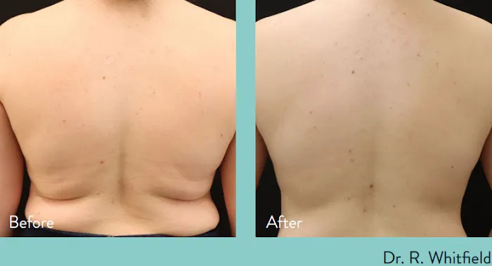 Zormeier Cosmetic Surgery and Longevity Center Picture 4