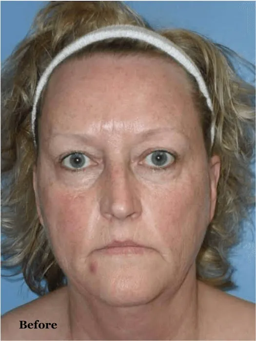 Zormeier Cosmetic Surgery and Longevity Center Picture 8