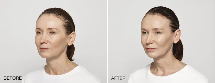 Zormeier Cosmetic Surgery and Longevity Center Picture 6