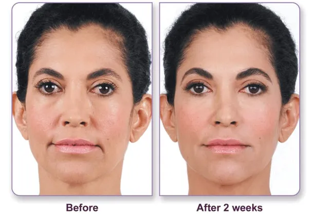 Zormeier Cosmetic Surgery and Longevity Center Picture 10