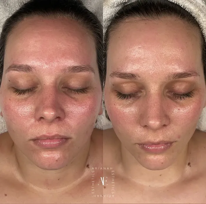 Arianah Esthetics Picture 6