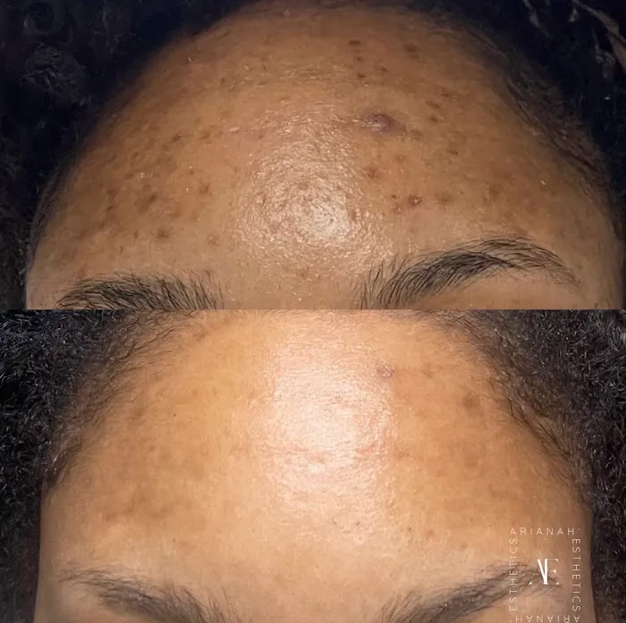 Arianah Esthetics Picture 4