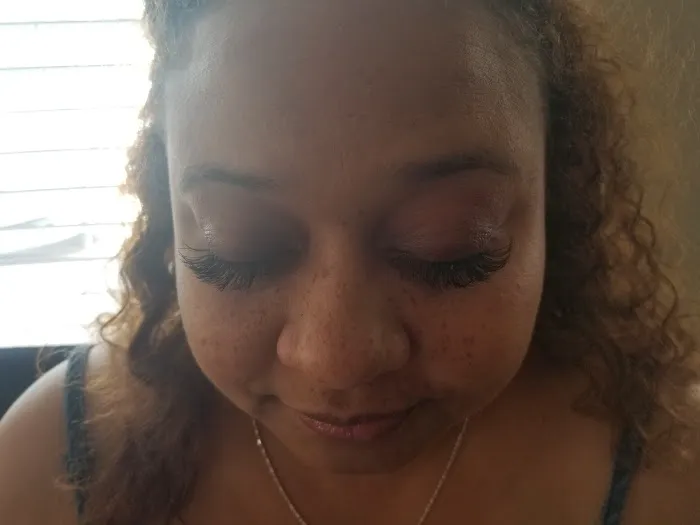 4everySKIN Esthetics Picture 4