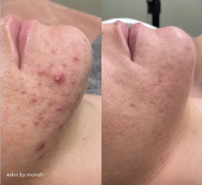 Skin by Moriah Picture 2