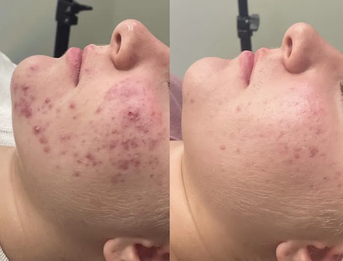 Skin by Moriah Picture 6