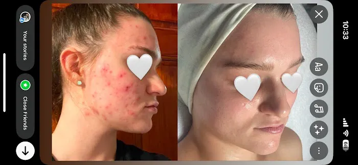 LUMI Esthetics Picture 2