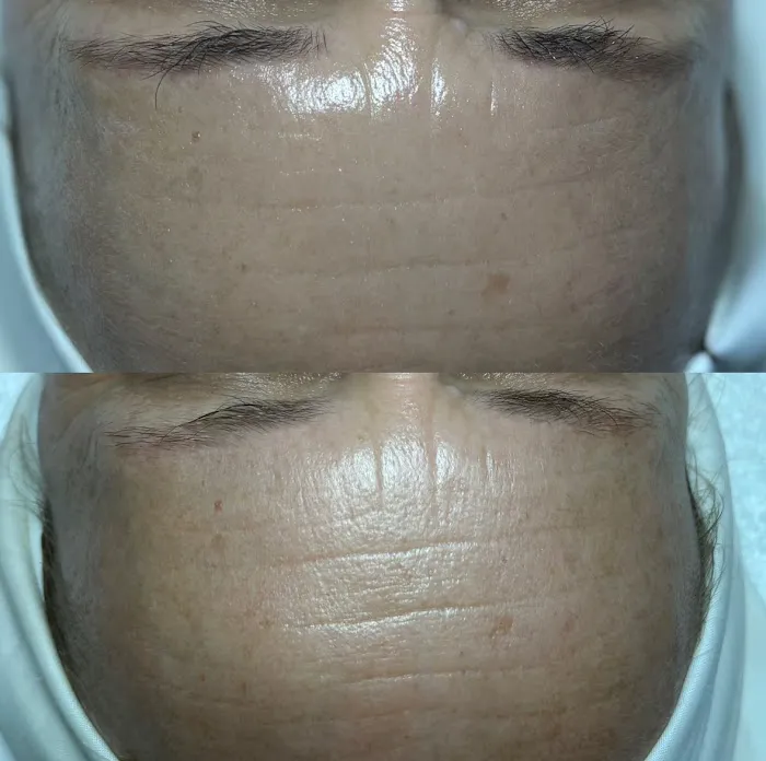 LUMI Esthetics Picture 6