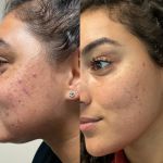 Advanced Skincare By Tanya