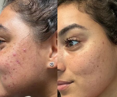 Advanced Skincare By Tanya