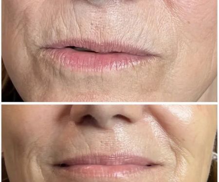 Right Now Skin and Hair Rejuvenation