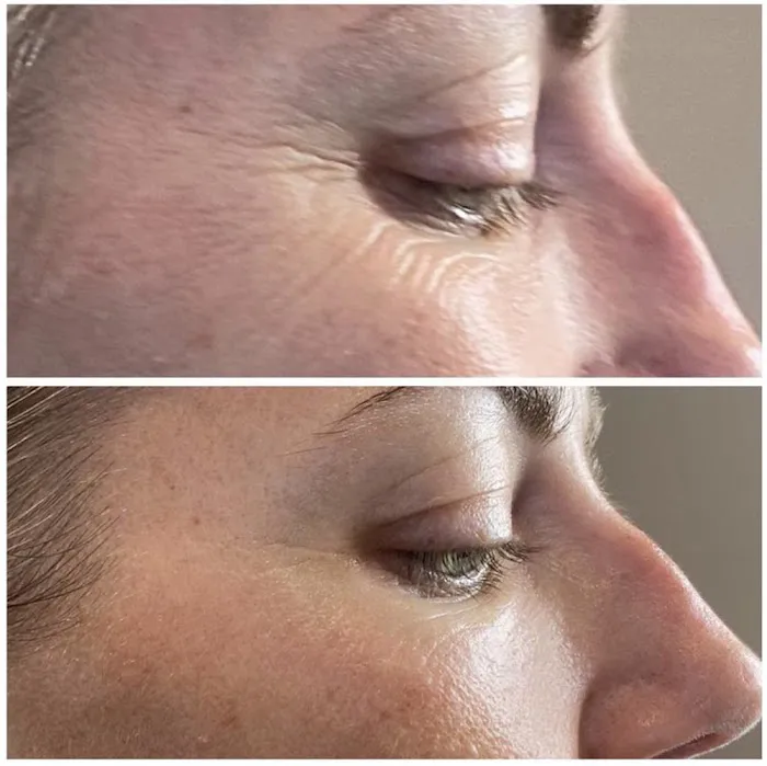 Right Now Skin and Hair Rejuvenation Picture 2