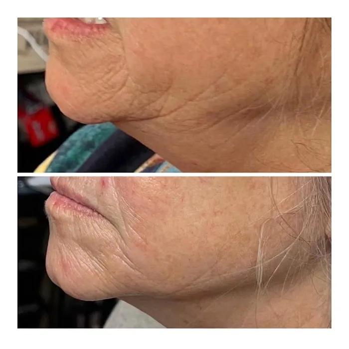 Right Now Skin and Hair Rejuvenation Picture 3