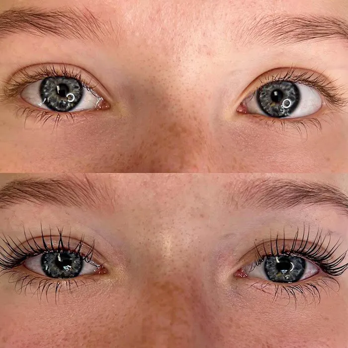 Aesthetic’s Skin & Acne Care Picture 9