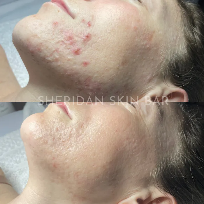 Sheridan Skin Bar Picture 7