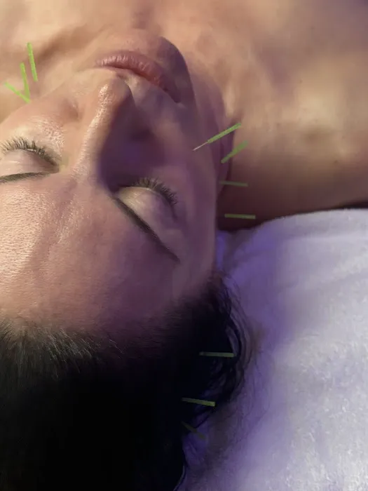 Margaret Webb, LAc/ Shaping Face Picture 9