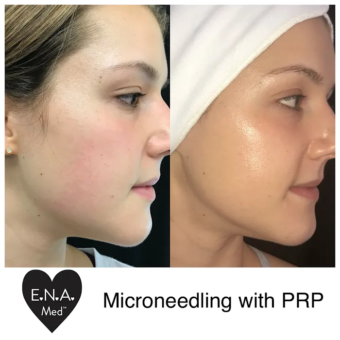 Nurse Karen Skincare & Aesthetics Picture 10