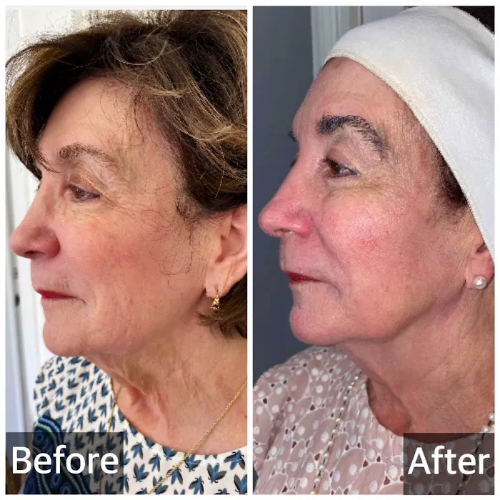 Nurse Karen Skincare & Aesthetics Picture 6