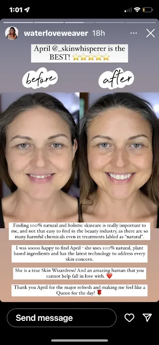 Skin Whisperer Picture 8