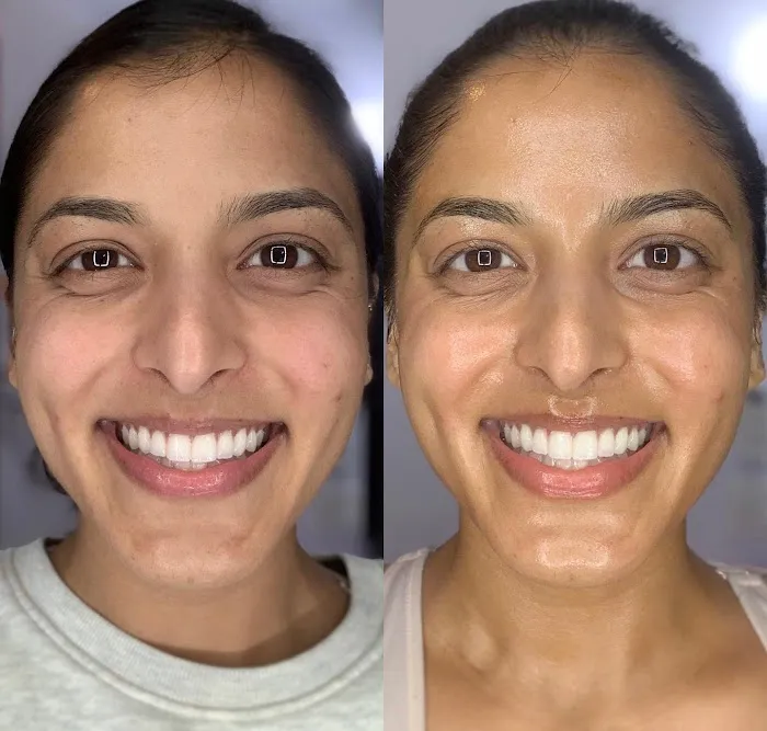 Skin Whisperer Picture 6