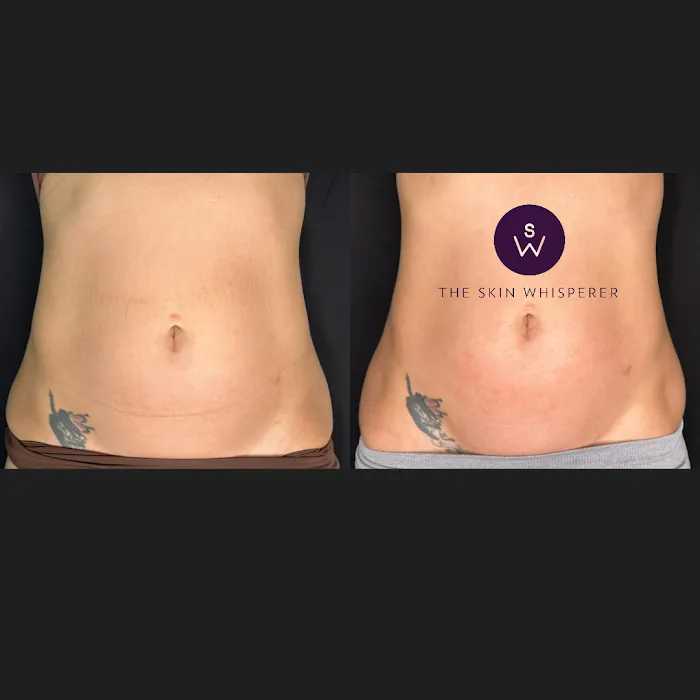 Skin Whisperer Picture 9