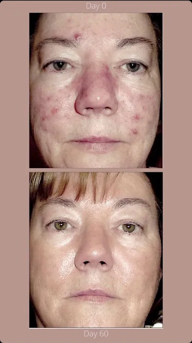 Rejuvenate Skincare & Wellness Picture 8