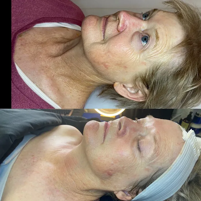 Rejuvenate Skincare & Wellness Picture 5