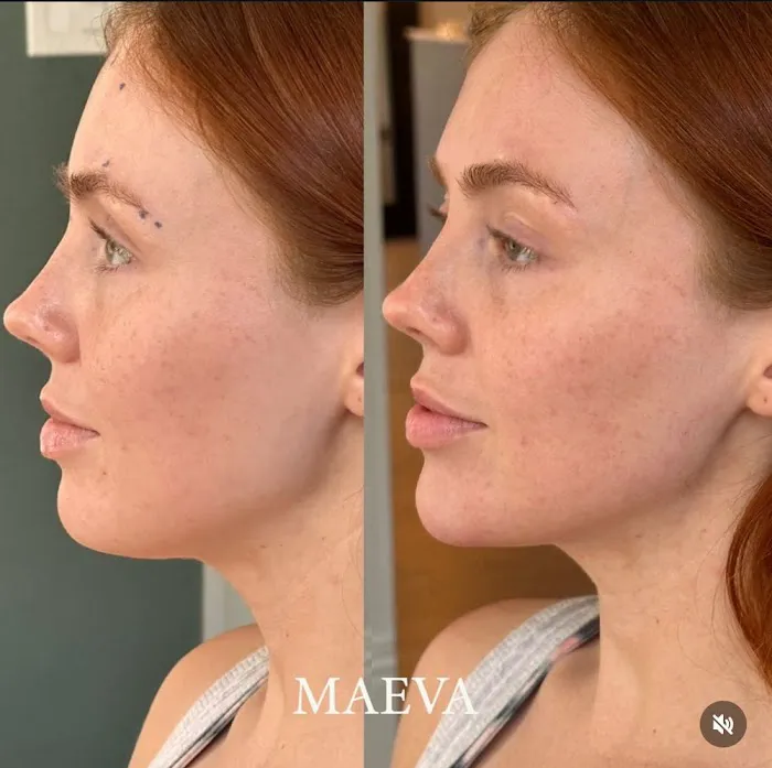 MAEVA Aesthetics Picture 9