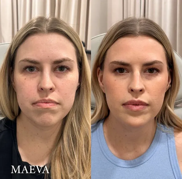 MAEVA Aesthetics Picture 2