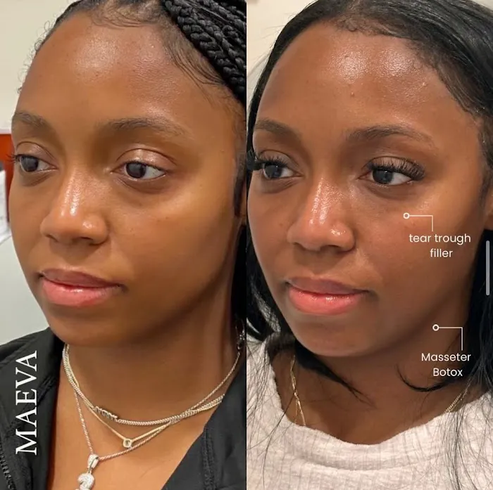 MAEVA Aesthetics Picture 10