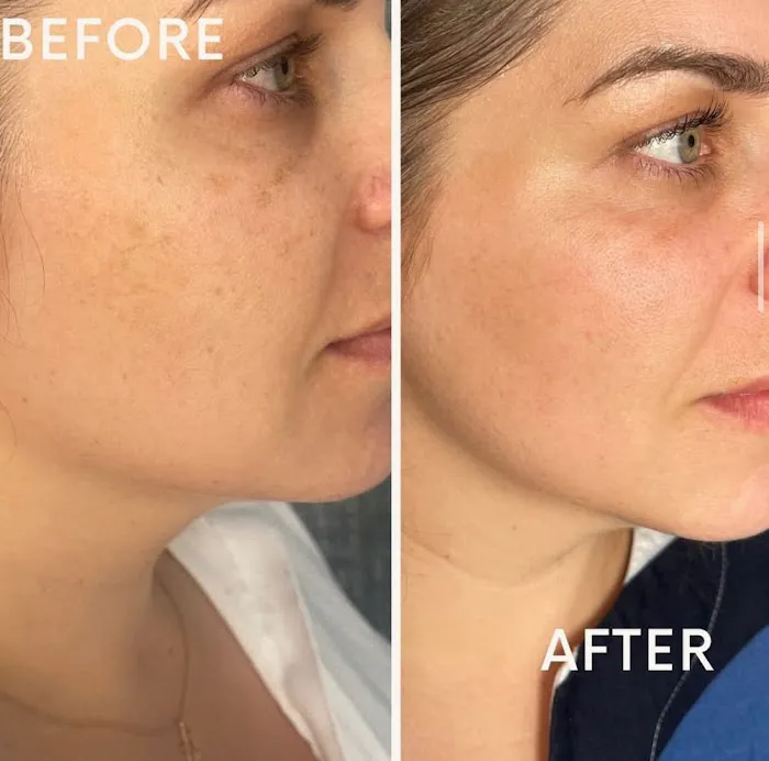 MAEVA Aesthetics Picture 6