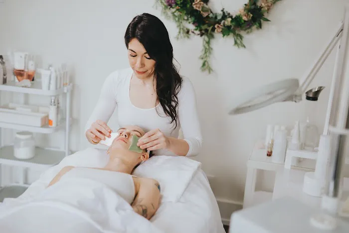 Carson Skin Rejuvenation Picture 5