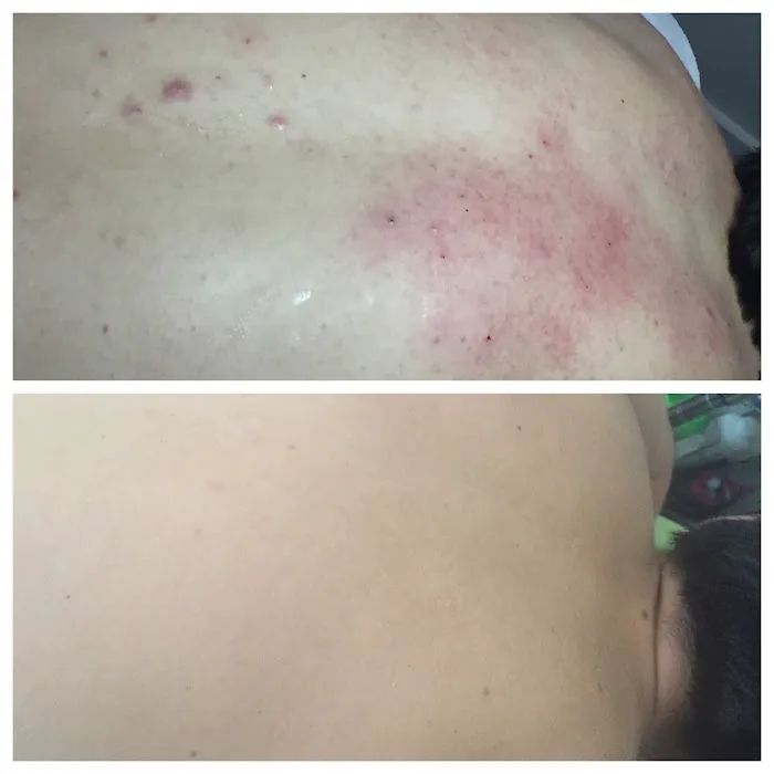 JA Skin Therapy Picture 8