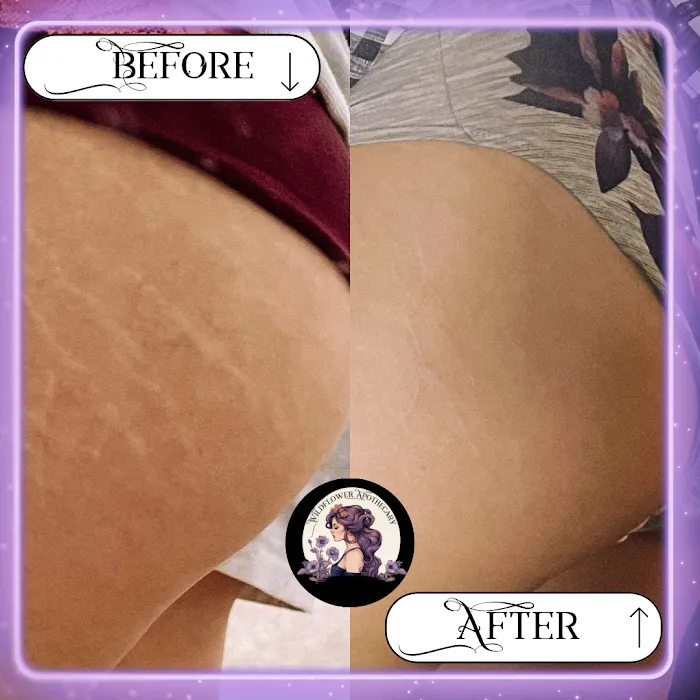 Wildflower Apothecary Picture 10