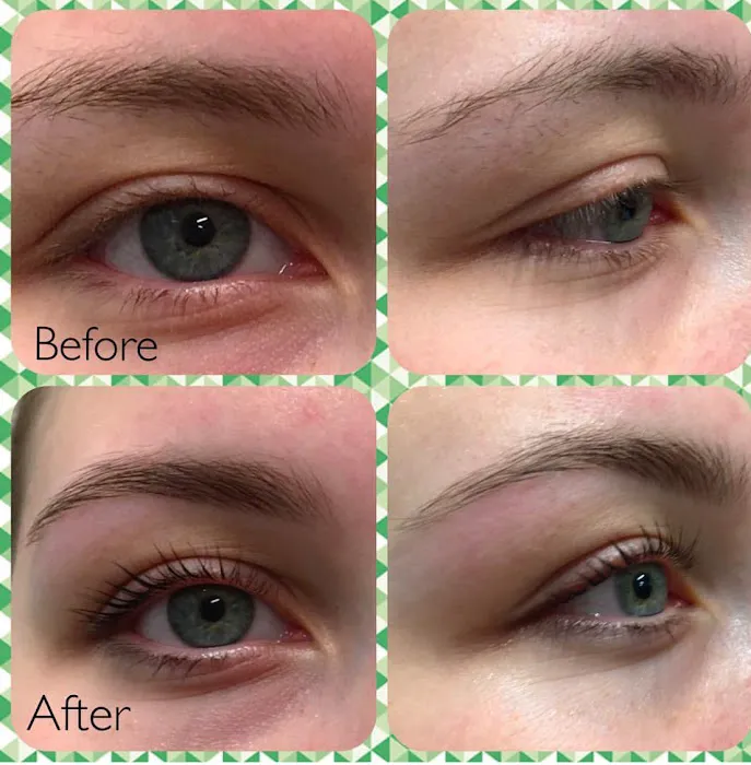 Pure Skin Spa And Beauty Lounge Picture 9