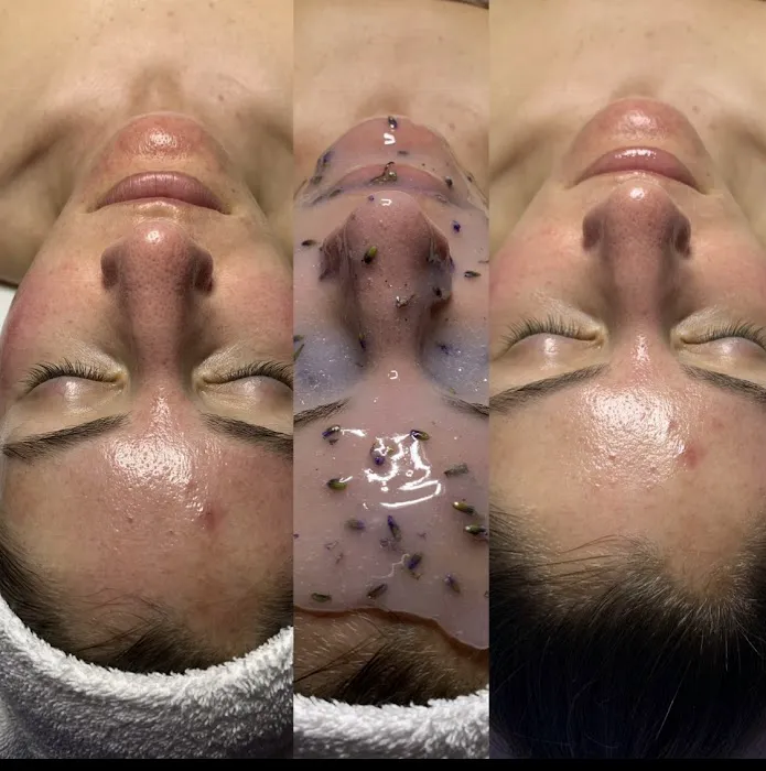 Aqua Luna Aesthetics Picture 2