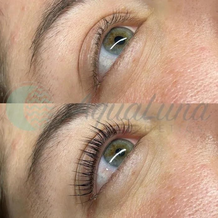 Aqua Luna Aesthetics Picture 3