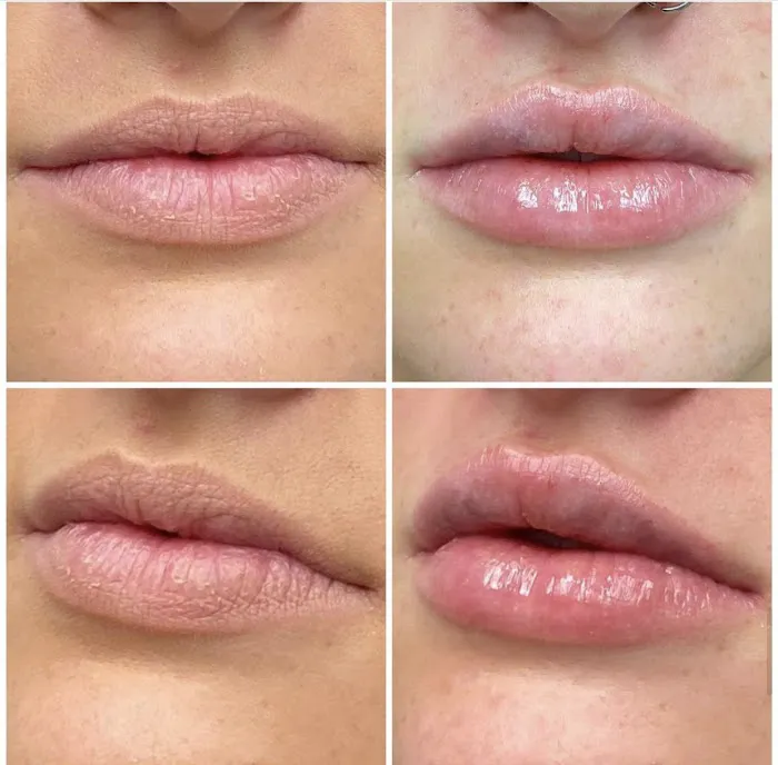 Med Physique Center For Aesthetics Picture 9