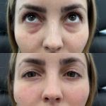 Caleb Martin, Austin Nurse Injector - Advanced Botox & Filler