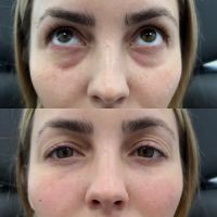 Caleb Martin, Austin Nurse Injector - Advanced Botox & Filler ico