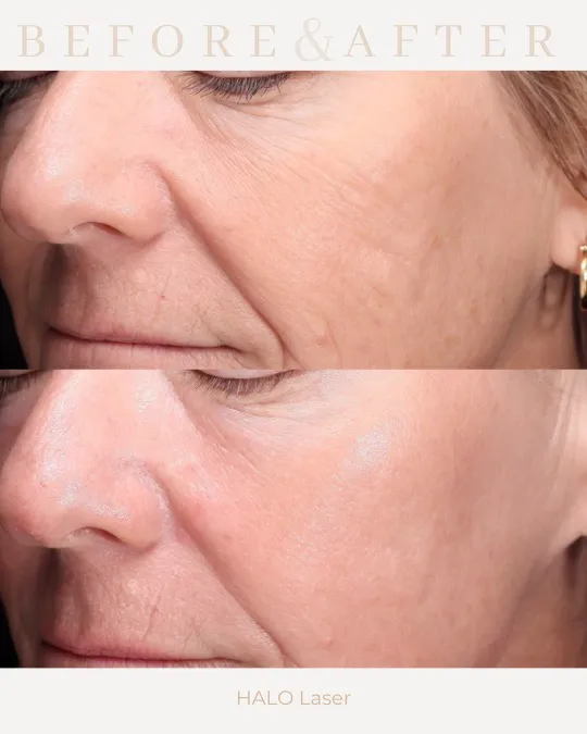 Caleb Martin, Austin Nurse Injector - Advanced Botox & Filler Picture 6