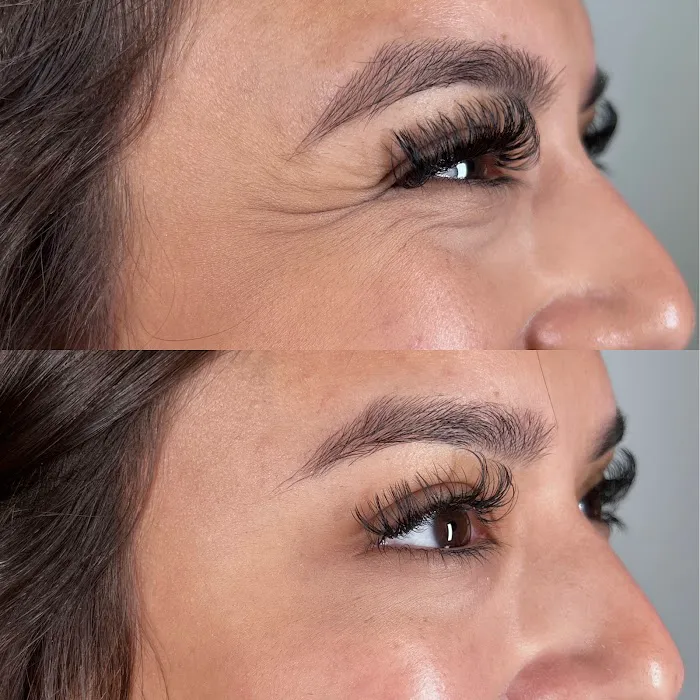 Caleb Martin, Austin Nurse Injector - Advanced Botox & Filler Picture 7