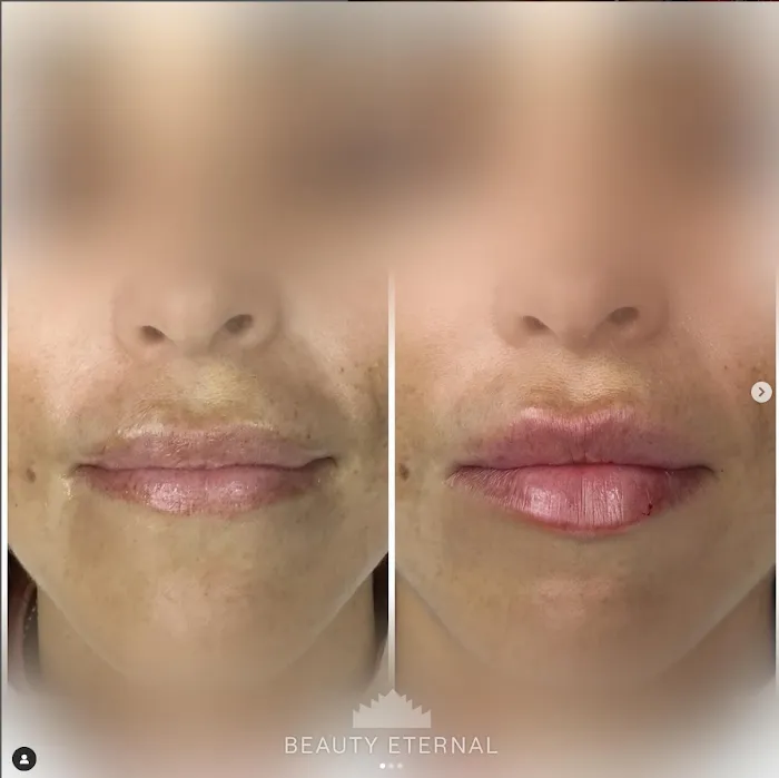 Beauty Eternal Picture 7