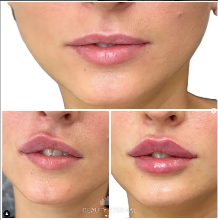 Beauty Eternal Picture 10