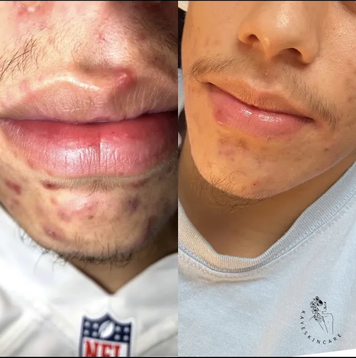 Kaye Skincare Picture 4