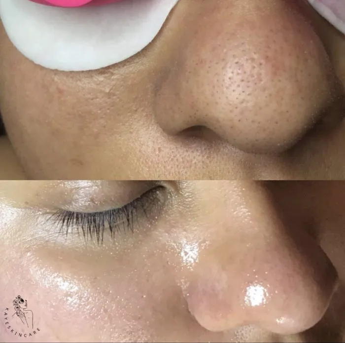 Kaye Skincare Picture 5