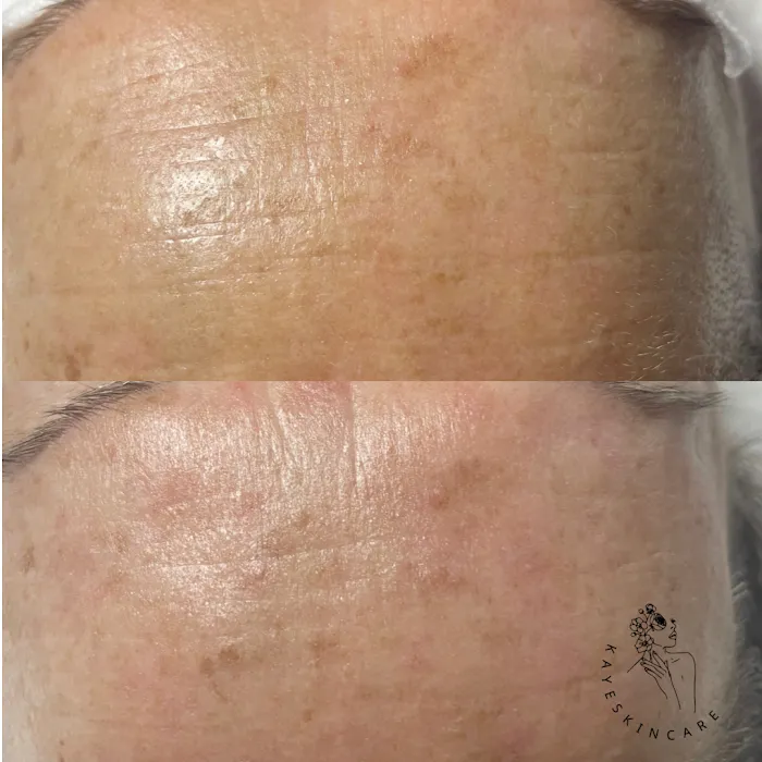 Kaye Skincare Picture 10