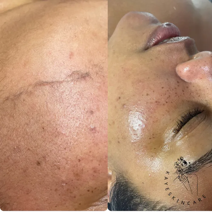 Kaye Skincare Picture 9