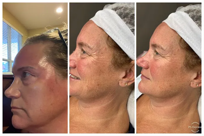 Cosmed-ttoo Picture 10