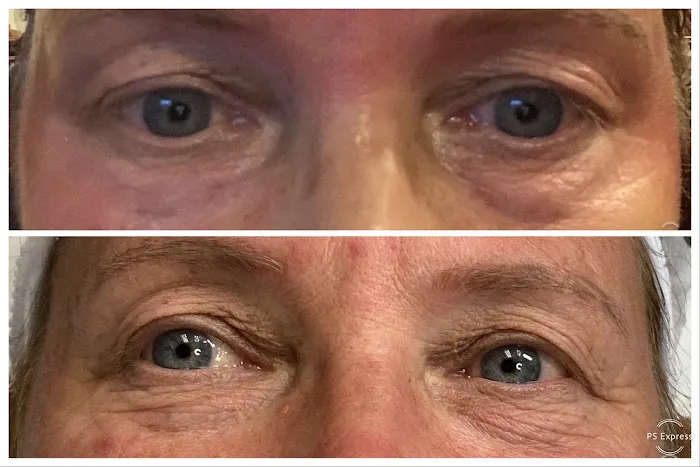 Cosmed-ttoo Picture 8