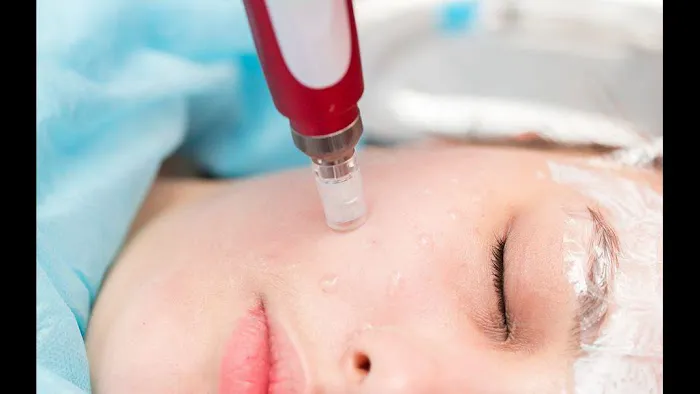 Cosmed-ttoo Picture 6